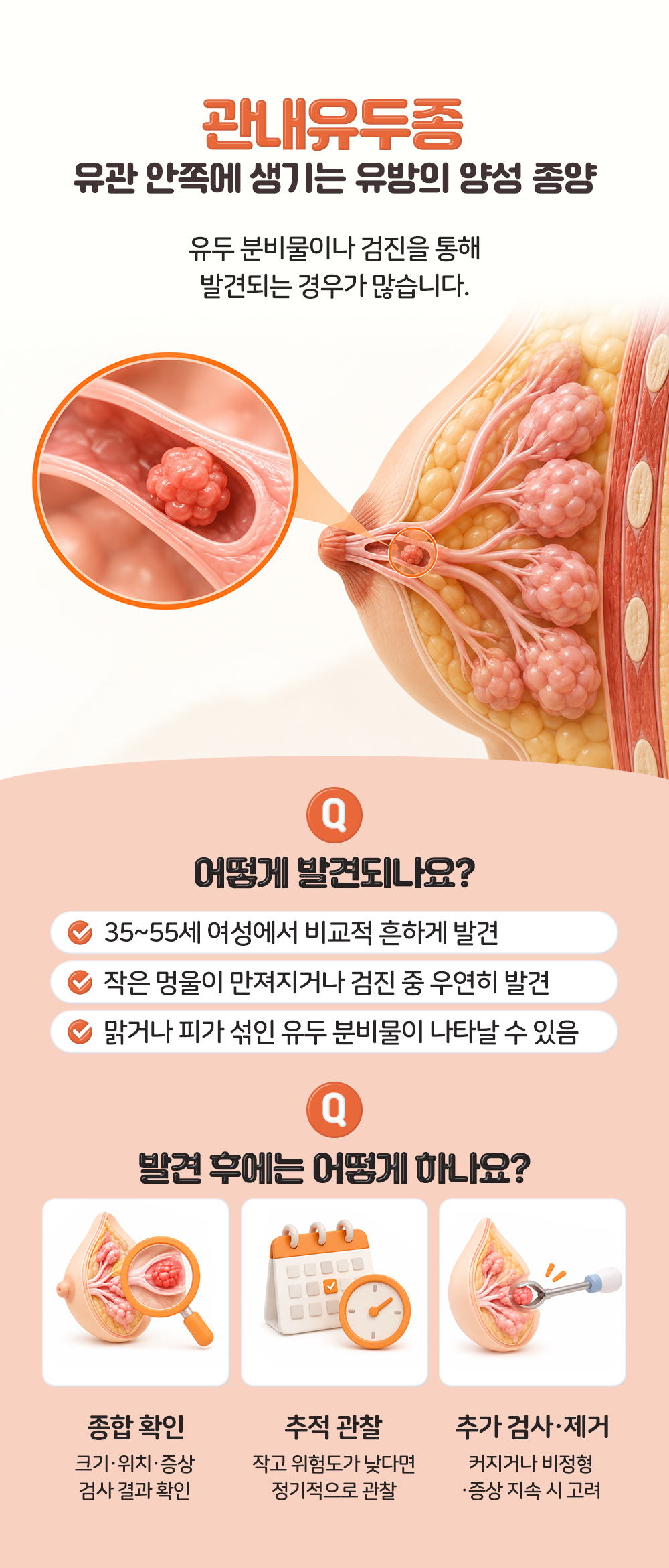 유관 안쪽에 생기는 양성 종양이라는 뜻과 발견 경로 셋, 발견 후 대응 셋