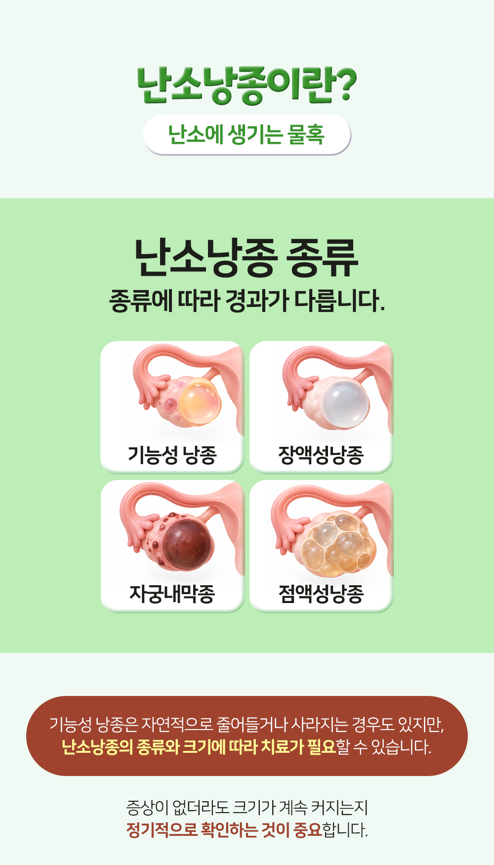난소에 생기는 물혹이라는 뜻과 기능성 낭종, 장액성낭종, 자궁내막종, 점액성낭종 네 종류를 그림으로 나눈 장