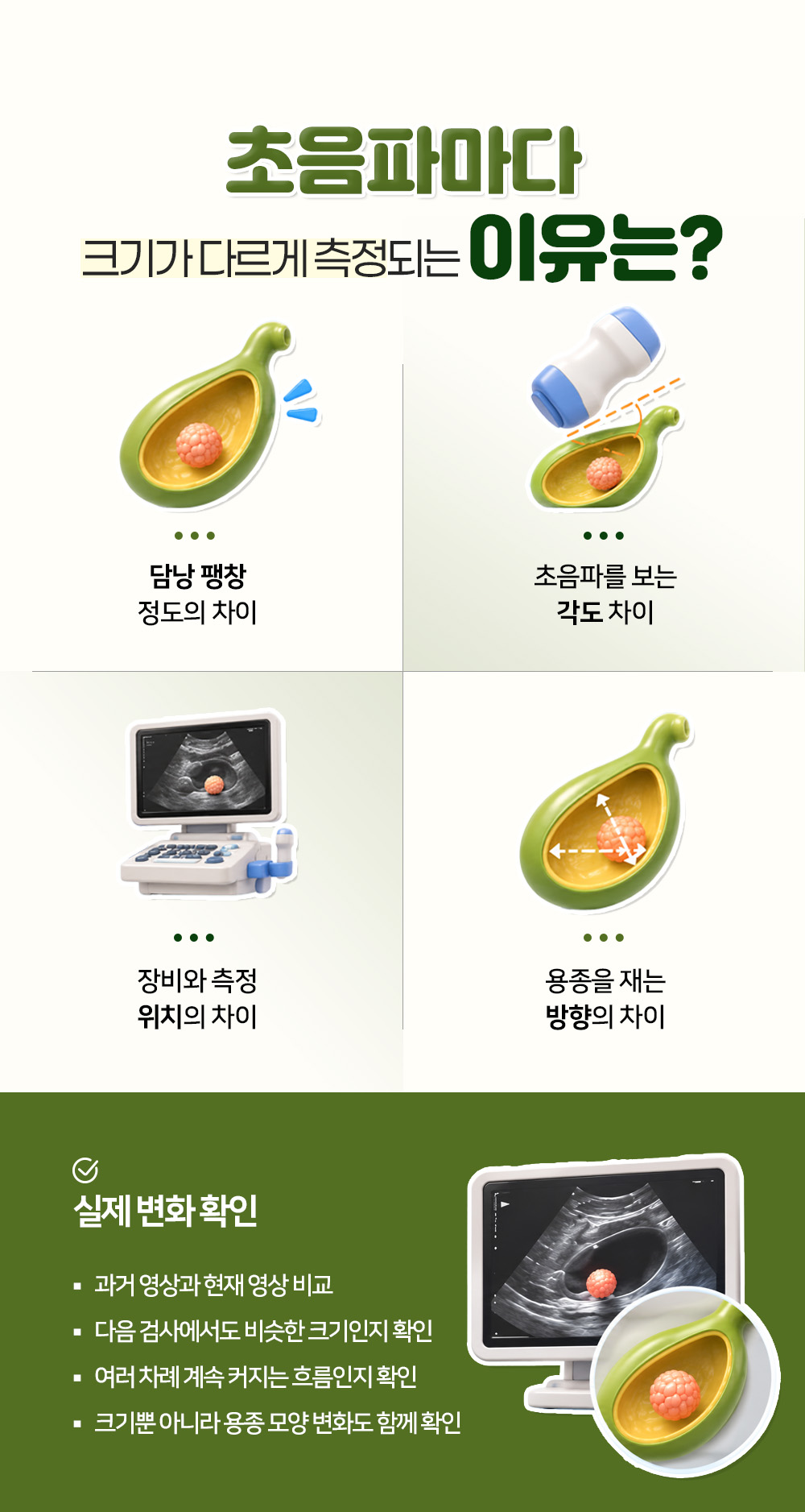 담낭 팽창과 각도, 장비와 재는 방향으로 측정값이 달라지는 이유 넷과 실제 변화 확인 넷