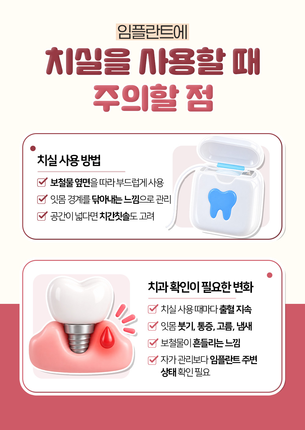 보철물 옆면을 따라 부드럽게 쓰는 치실 사용 방법과 출혈 지속, 고름, 보철물 흔들림처럼 치과 확인이 필요한 변화