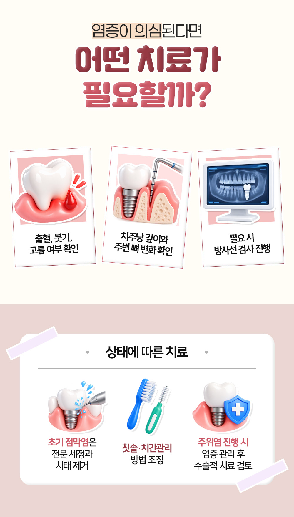 출혈과 고름, 치주낭 깊이와 방사선 검사로 염증 정도를 확인하고 점막염과 주위염 상태에 따라 치료를 나눈 장