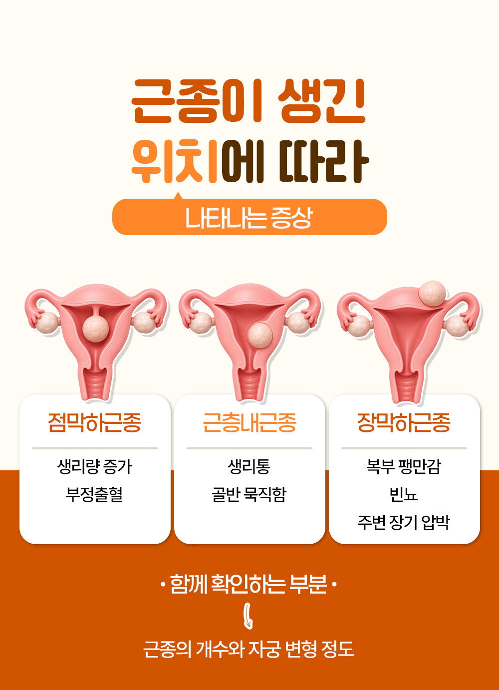 점막하근종과 근층내근종, 장막하근종으로 근종이 생긴 위치에 따라 나타나는 증상을 나눈 장