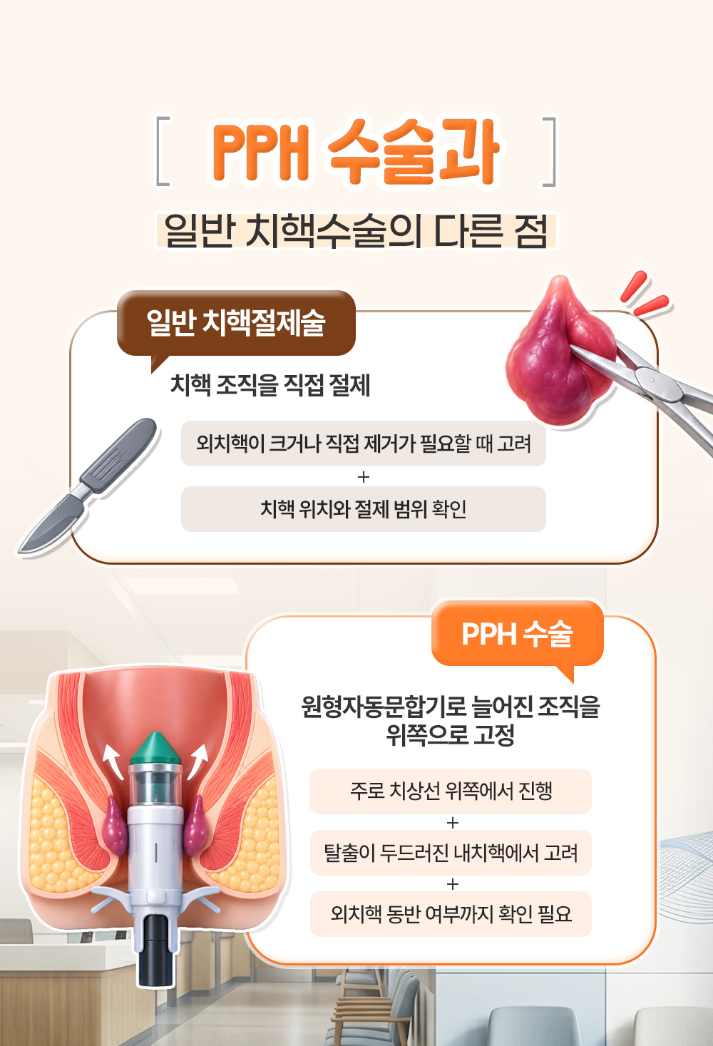치핵 조직을 직접 절제하는 방법과 원형자동문합기로 위쪽에 고정하는 방법의 차이
