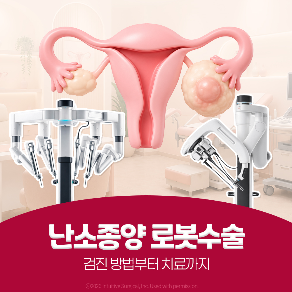 난소종양, 양성과 경계성 악성 구분부터 로봇수술까지