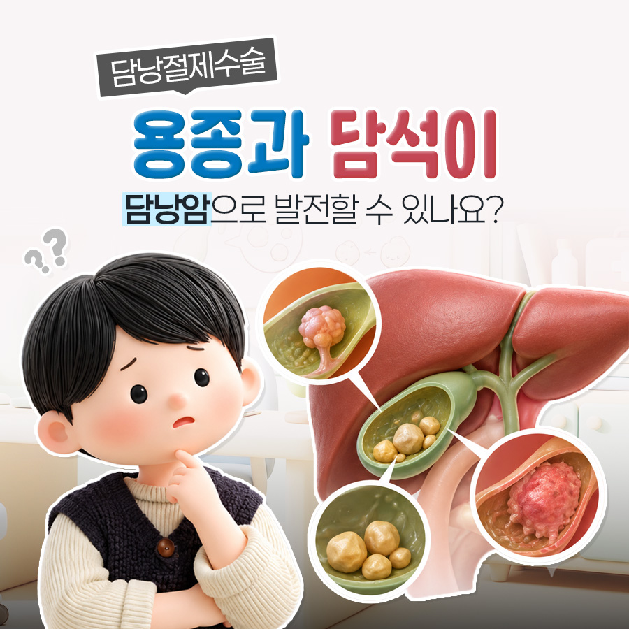 담낭용종과 담석, 담낭암 위험부터 담낭절제술 기준까지
