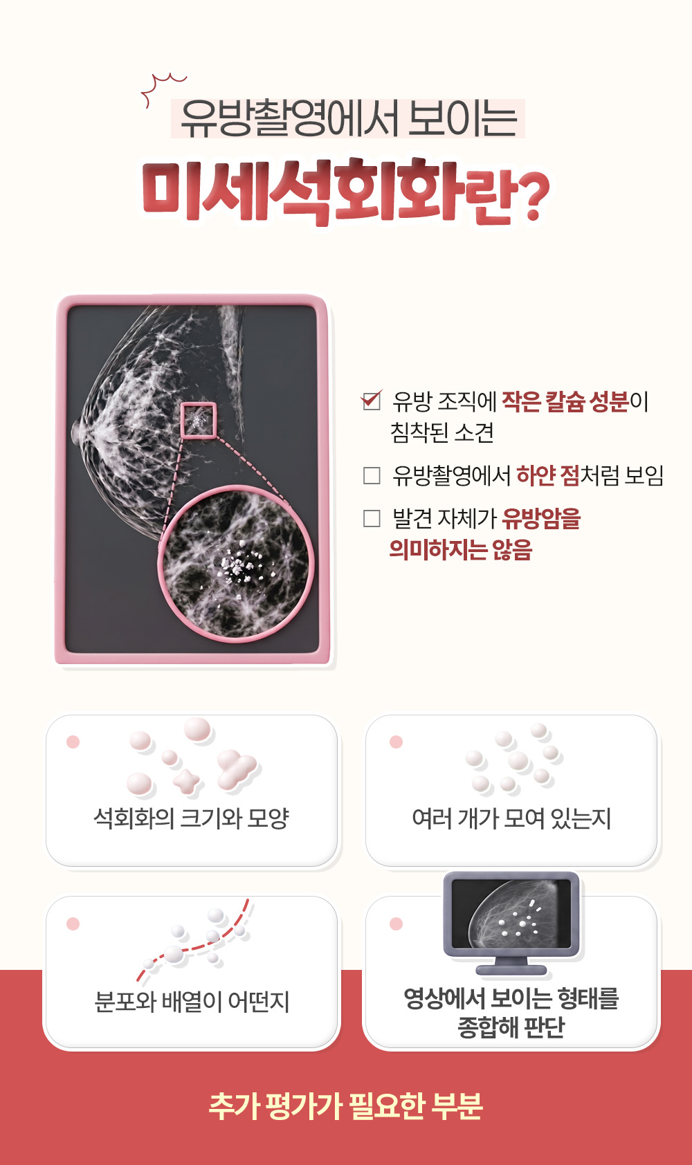 작은 칼슘 성분이 침착된 소견이라는 뜻 셋과 추가 평가가 필요한 부분 넷