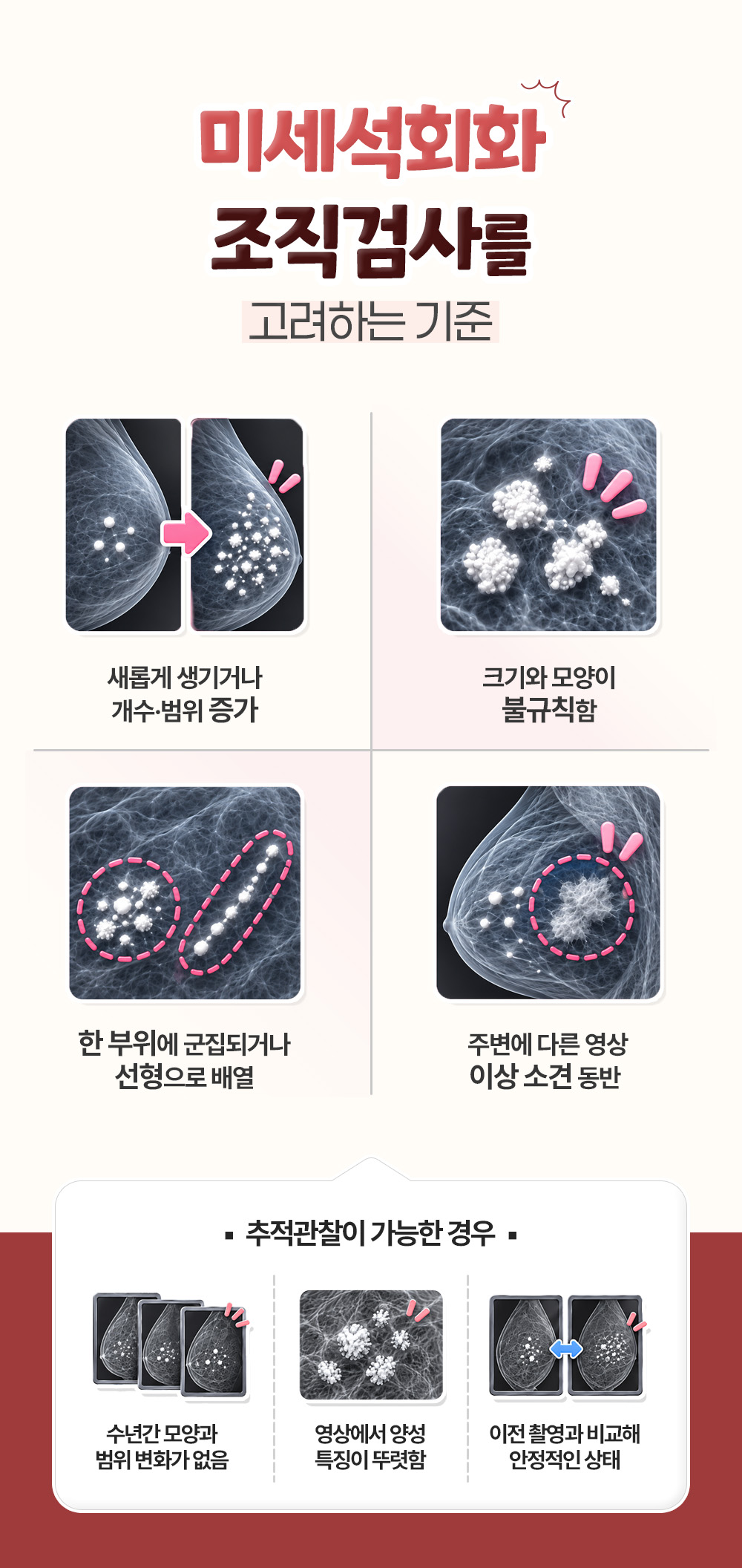새로 생기거나 불규칙한 변화 넷을 위에 두고 추적관찰이 가능한 경우 셋을 아래에 둔 장