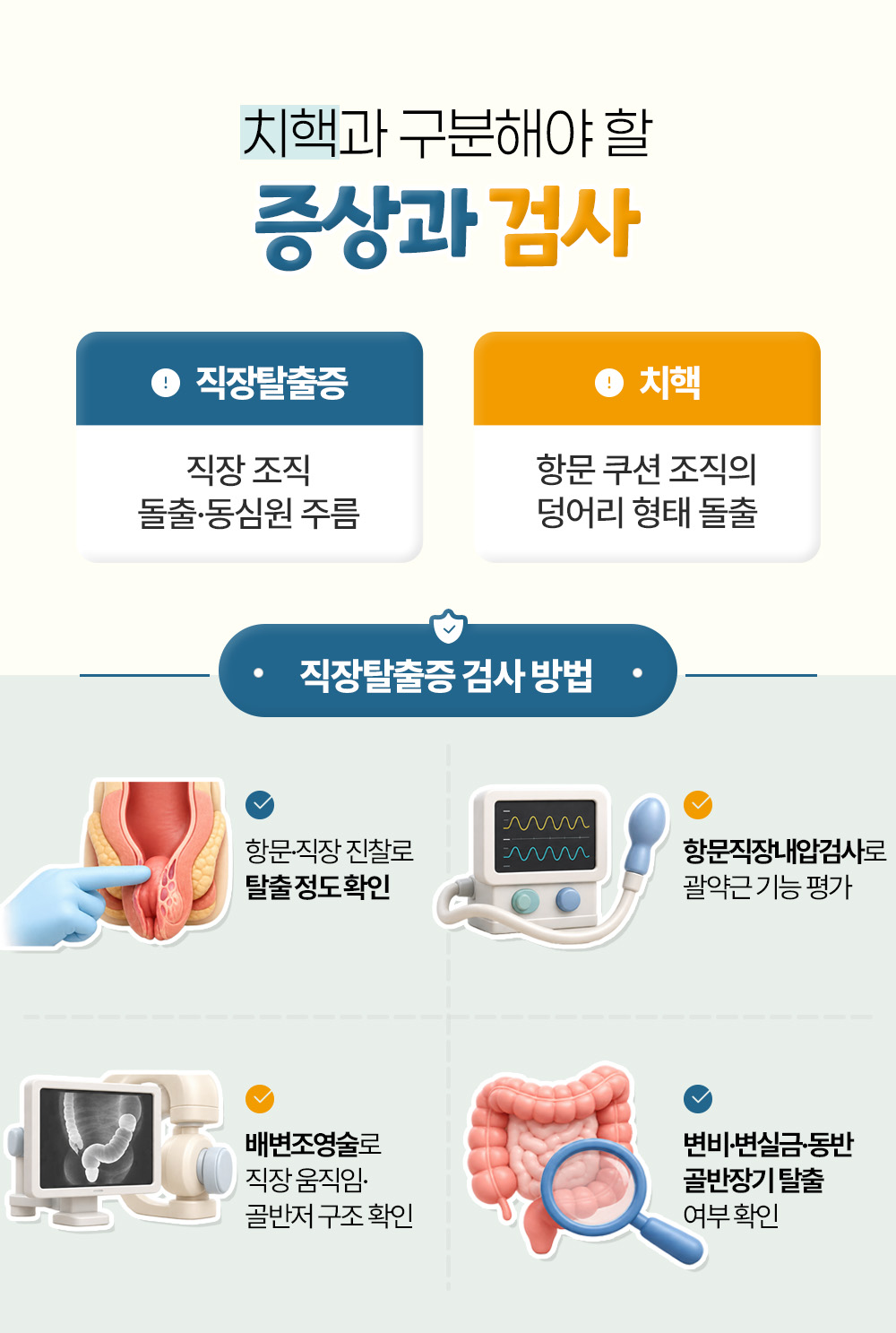 동심원 주름의 직장탈출증과 덩어리 형태의 치핵을 나란히 놓고 진찰·항문직장내압검사·배변조영술 등 검사 넷을 적은 장