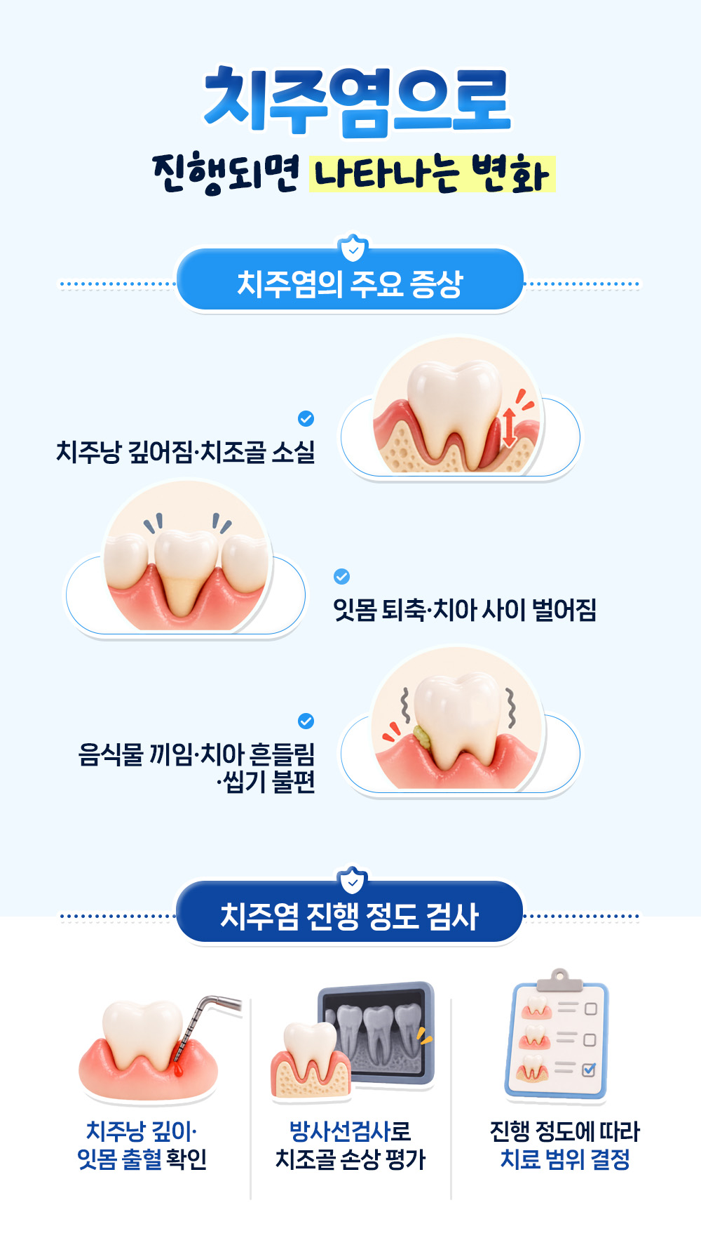 치주낭이 깊어지고 치조골이 줄어드는 치주염 증상 셋과 치주낭 깊이 측정, 방사선검사로 진행 정도를 보는 검사 셋